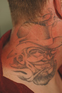 Laser Tattoo Removal Questions & treatments
