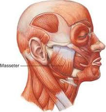 Migraines and Teeth Grinding - Masseter