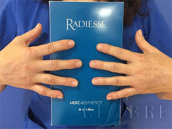 radiesse for hand rejuvenation
