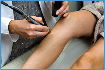 laser hair removal chicago black skin