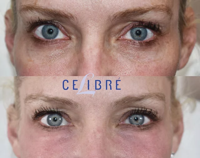How do you get wrinkle-free skin? She's 70 years old and looks 30,  unbelievable! 