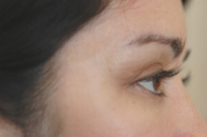 Aesthetic Treatments for the Holidays