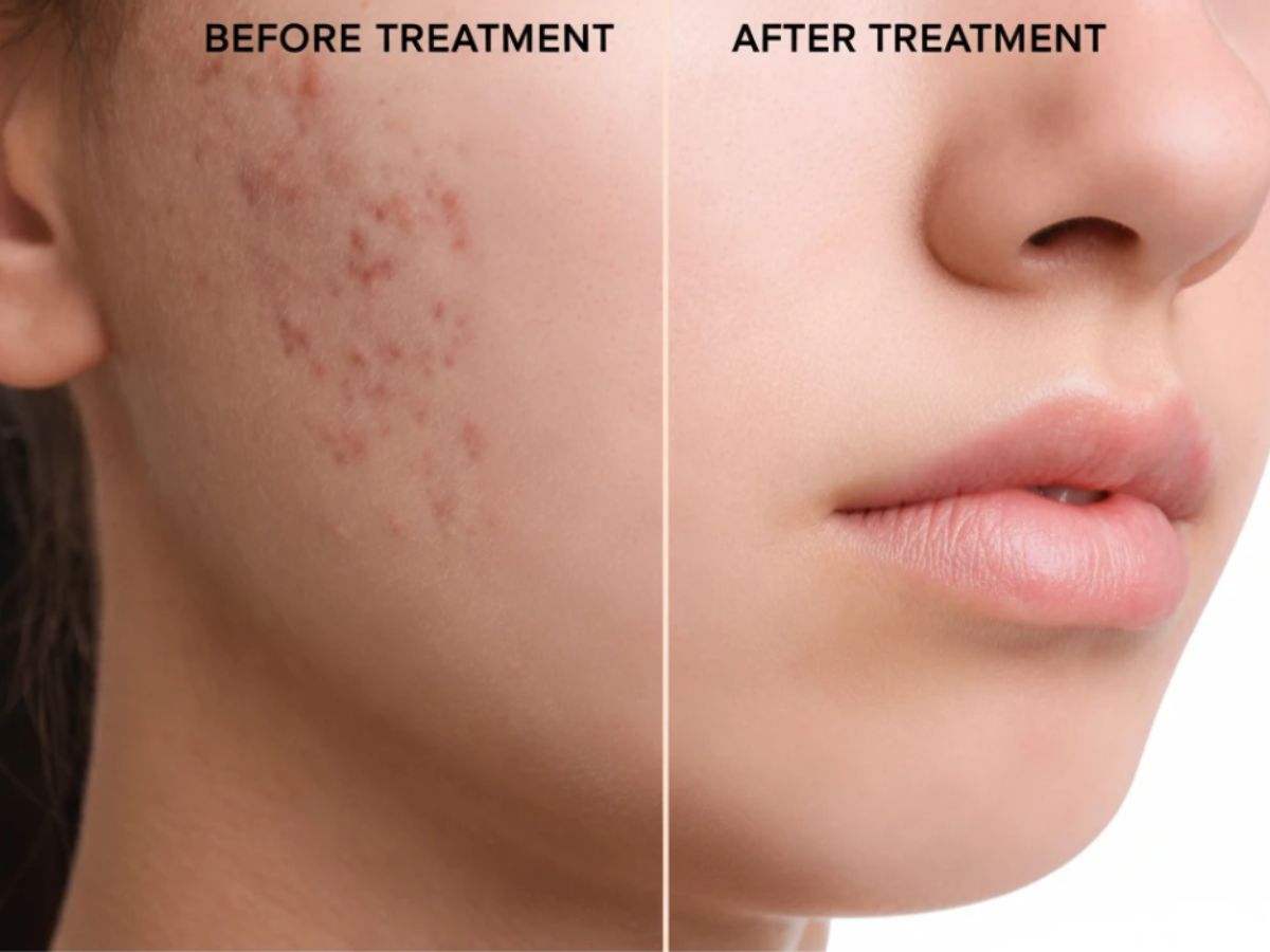 Dark Sports Before and After