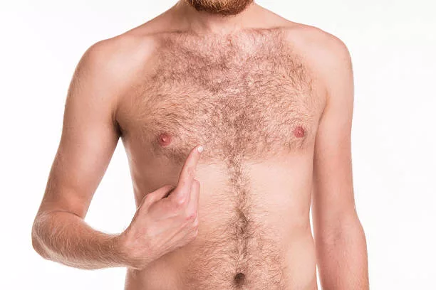Get Rid of Chest Hair