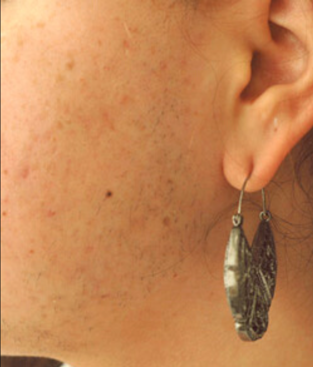 Newsletter July Injections