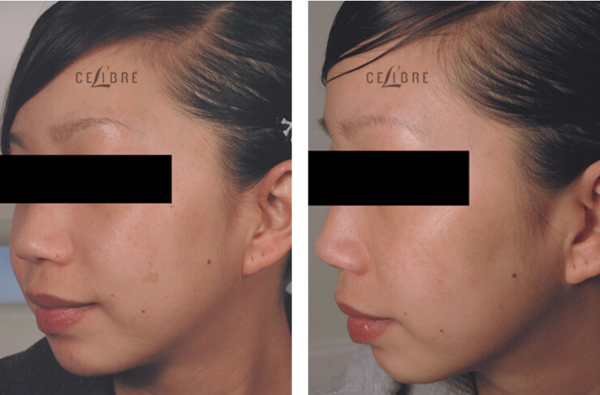 rejuvenation meaning