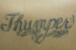 tattoo scar removal